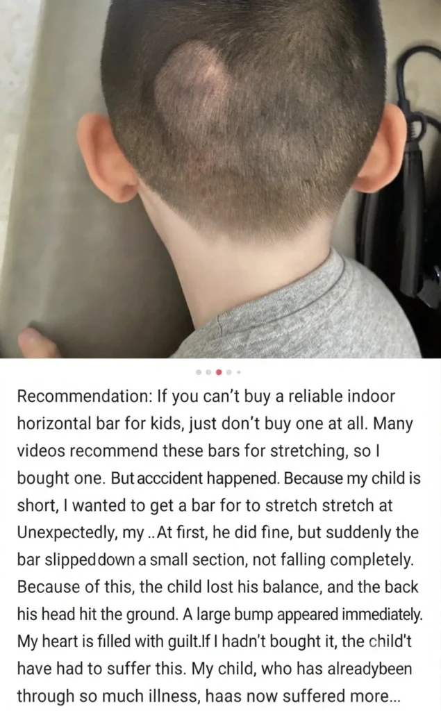 Child head injury caused by no-drill pull up bar danger accidents